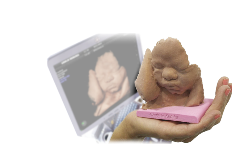 Baby3Dprint